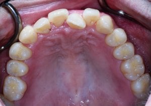 developed-dental-arch