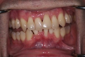 developed-dental-arch